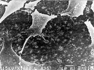 AZoM - Metals, Ceramics, Polymer and Composites : Hydroxyapatite Composite Biomaterials – Biological behaviour